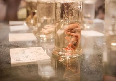 去泰国做试管婴儿费用明细包含哪些？多少钱解读