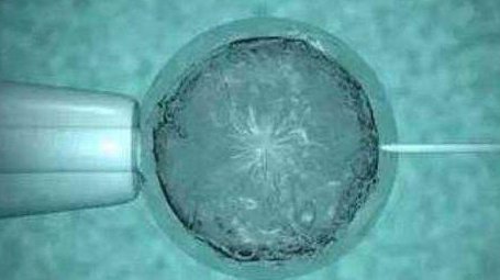 深圳哪家医院做三代试管婴儿好？