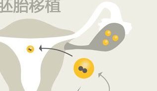 保定唐县试管婴儿多少钱？保定唐县试管婴儿多少钱啊